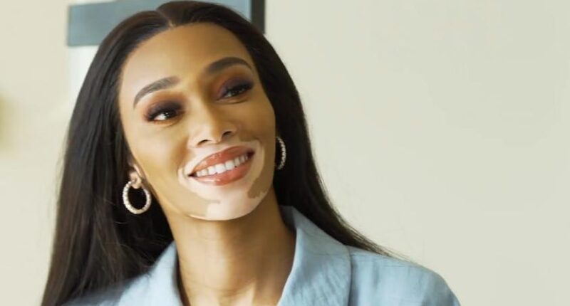 Winnie Harlow Net Worth 2022